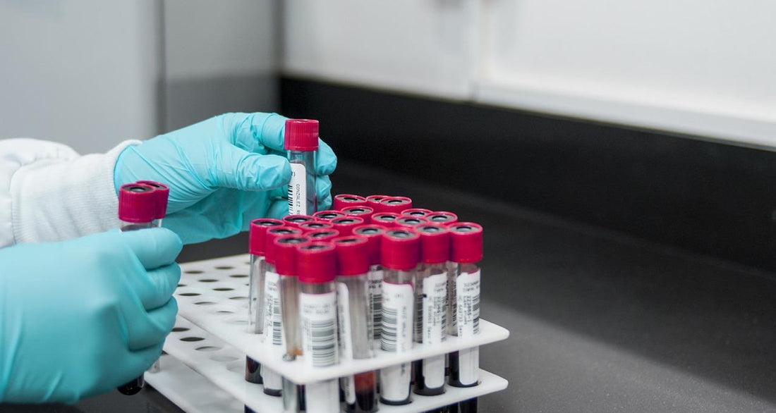 Can a Simple Blood Test Detect Cancer in Dogs?
